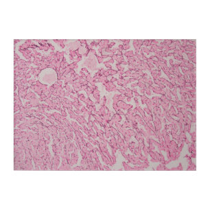 Histology Art (Reticulin) - 2