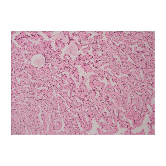 Histology Art (Reticulin) - 2 (Front)