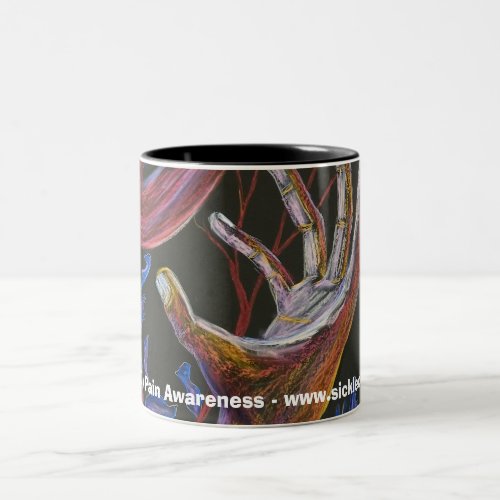 Hope _ Sickle Cell Art Two_Tone Coffee Mug