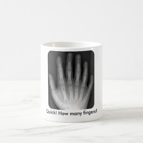 How many fingers Xray Coffee Mug