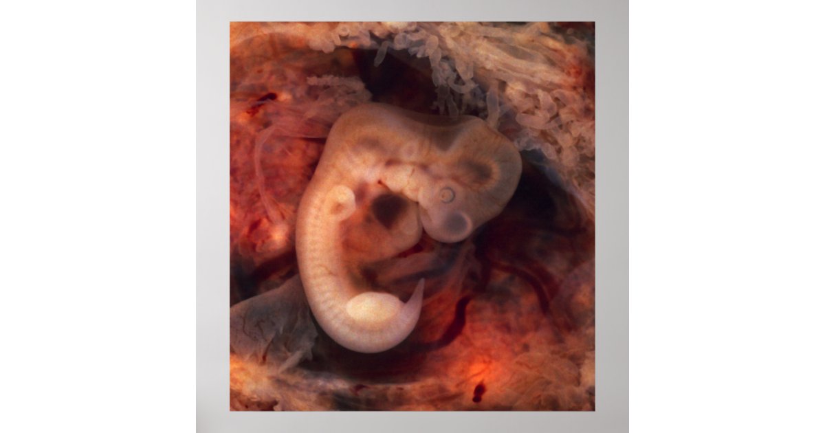 Human Embryo 7th Week Of Pregnancy 5th Peek P O Poster