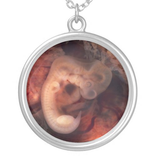 Human Embryo 7th Week of Pregnancy 5th Peek PO Silver Plated Necklace