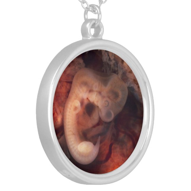 Human Embryo 7th Week of Pregnancy 5th Peek P.O. Silver Plated