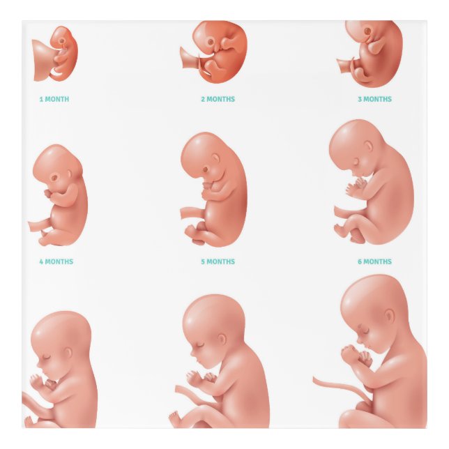 Human Fetus Acrylic Print (Front)