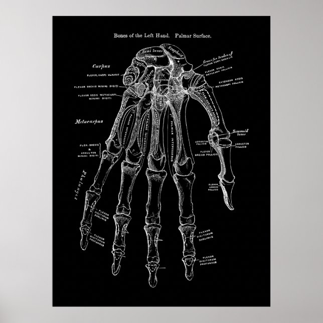 Human Hand Bone Anatomy Art Poster (Front)