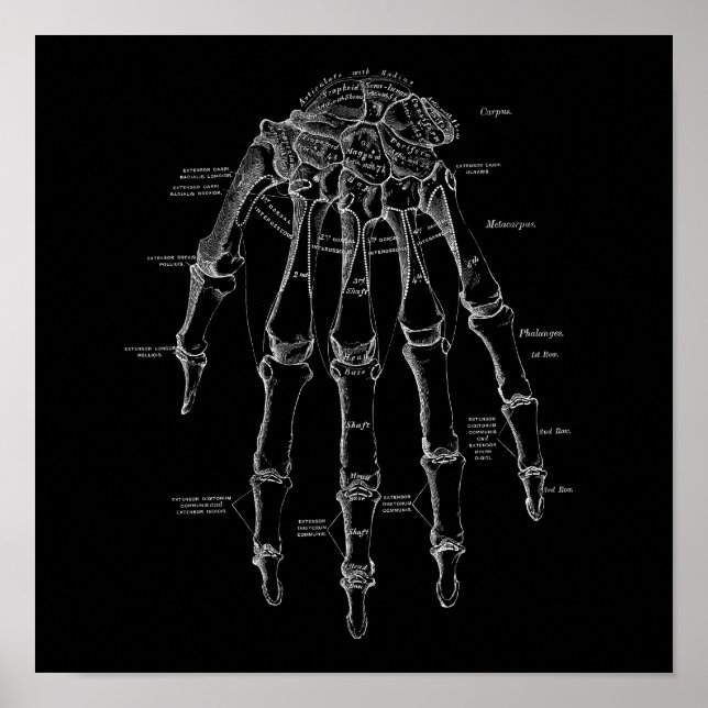 Human Hand Bones Anatomy Illustration Old Medical Poster (Front)