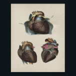 Human Heart Anatomy Vintage Print<br><div class="desc">Three views of the human heart. The image is created from vintage anatomical illustrations from: A Series of Anatomical Plates by Jones Quain, M.D. Titled: The Structure of the Different Parts of The Human Body. Published in 1854. We increased the size of the margins so you can choose your own...</div>