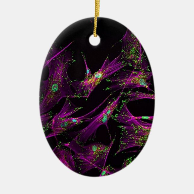 Human lung fibroblasts ceramic ornament (Front)