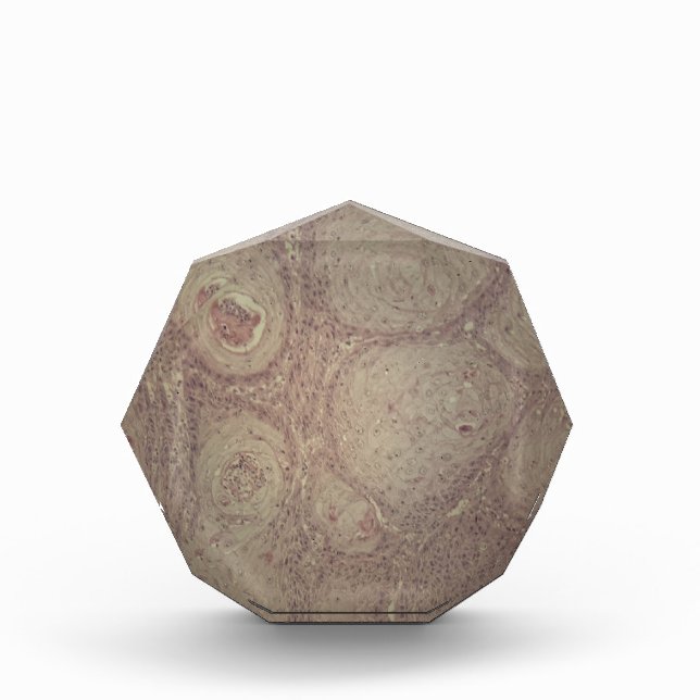 Human skin with squamous cell carcinoma award (Front)