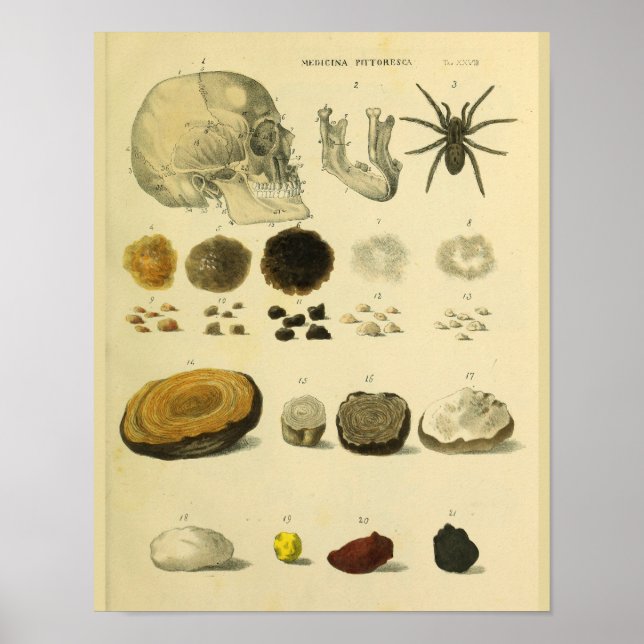 Human Skull Spider Medical Anatomy Art Print (Front)