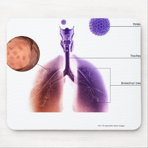 Illustration of an asthma attack from pollen mouse pad