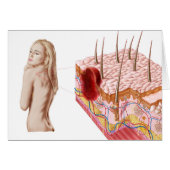 Illustration Of An Atypical Growth On The Skin (Front Horizontal)