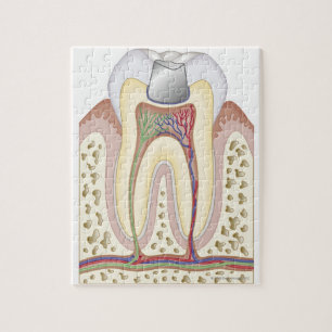 Illustration of Dental Filling Jigsaw Puzzle