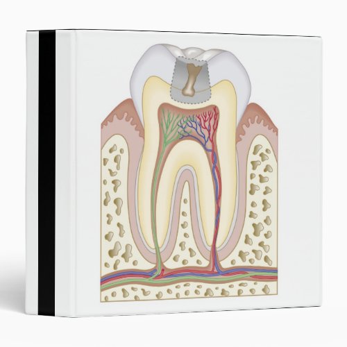 Illustration of Tooth Decay 3 Ring Binder