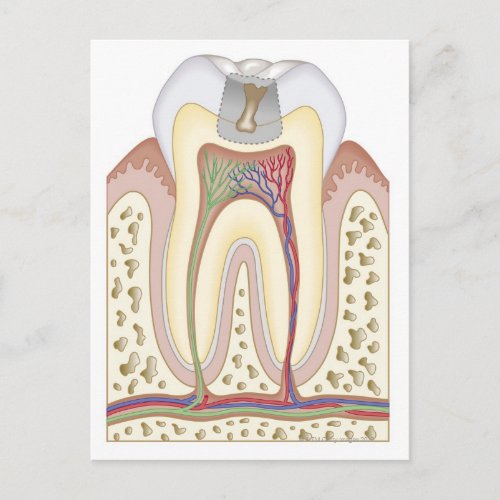 Illustration of Tooth Decay Postcard