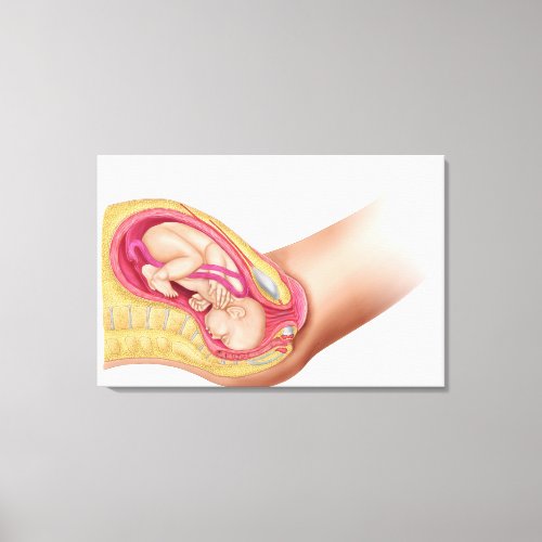 Illustration Showing Delivery Of Fetus 2 Canvas Print