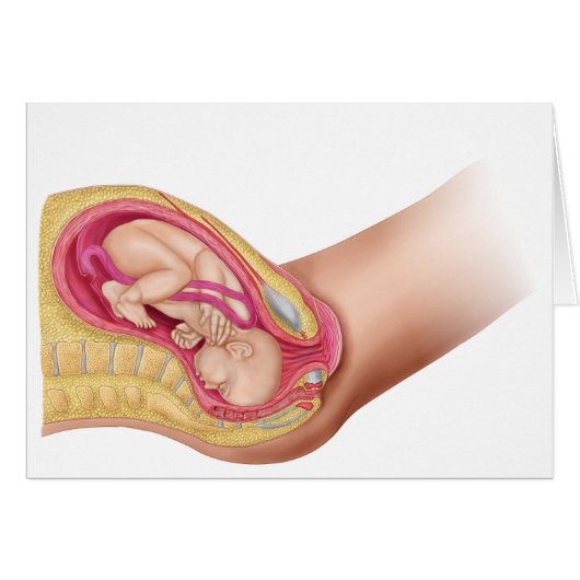 Illustration Showing Delivery Of Fetus 2 Cards (Front Horizontal)