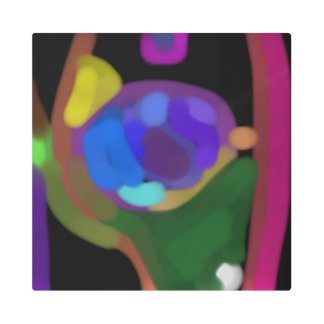 In the Forest Metal Print