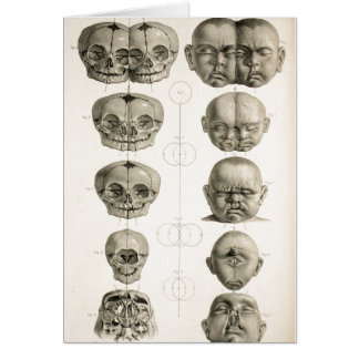 Infant Skull Deformities Weird/Conjoin Baby Cards