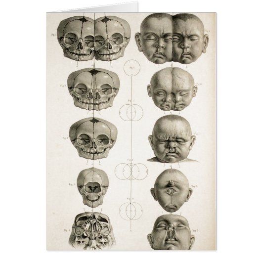 Infant Skull Deformities Weird/Conjoin Baby Cards (Front)