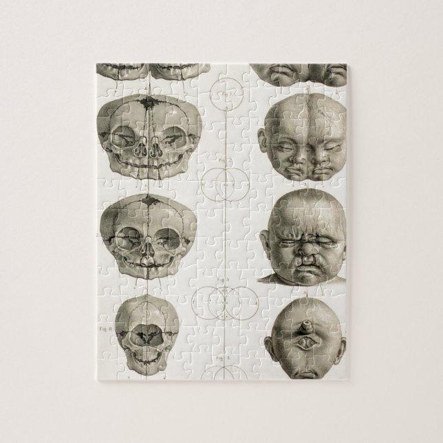 Infant Skull Deformities Weird/Conjoin Baby Jigsaw Puzzle (Vertical)