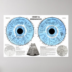 Iridiagnosis Iridology Eye Chart 