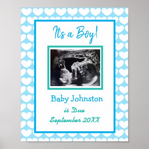 Its a Boy Pregnancy Announcement Ultrasound Pic Poster