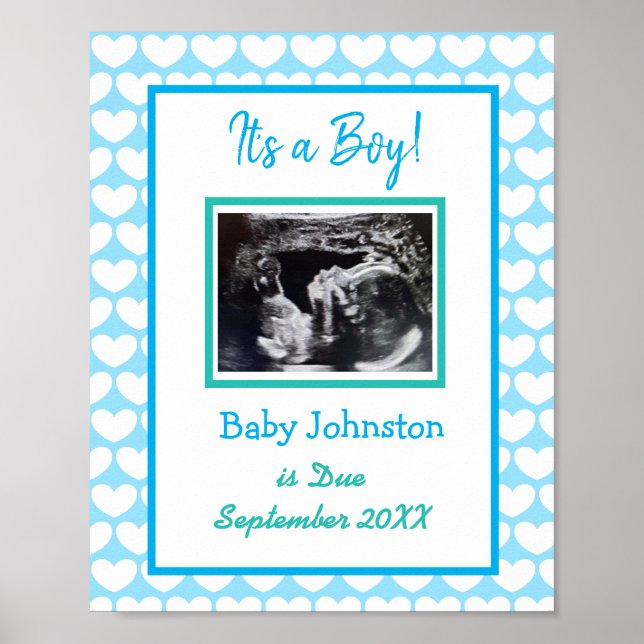 It's a Boy, Pregnancy Announcement Ultrasound Pic Poster (Front)