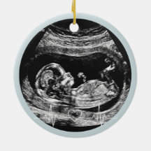 Its a Boy Ultrasound Pregnancy Announcement Baby