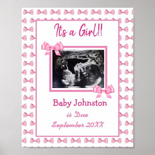 Its a Girl Pregnancy Announcement Ultrasound Pic Poster