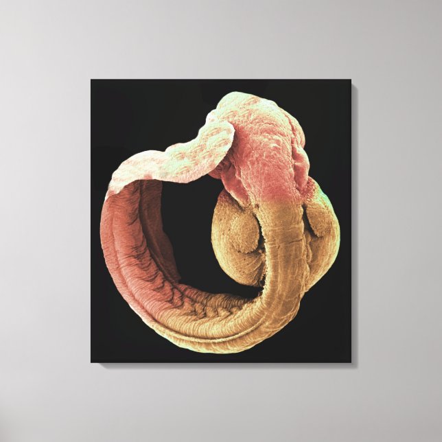 Japanese Medaka Fish embryo Canvas Print (Front)