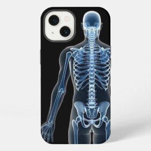 John Doe X-ray iPhone 13 Case