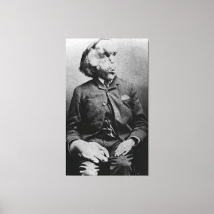 Joseph "John" Merrick The Elephant Man from 1889 Canvas Print