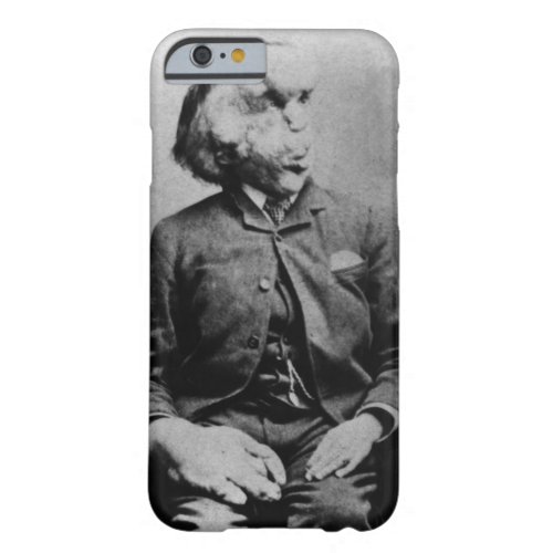 Joseph John Merrick The Elephant Man from 1889 Barely There iPhone 6 Case