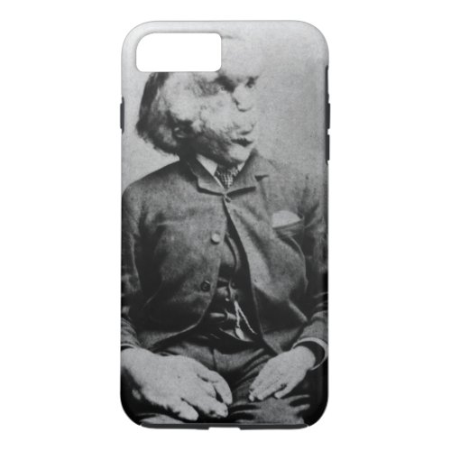 Joseph John Merrick The Elephant Man from 1889 iPhone 8 Plus7 Plus Case