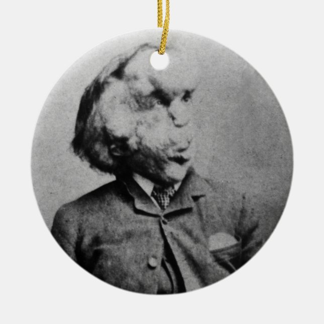 Joseph "John" Merrick The Elephant Man from 1889 Ceramic Ornament (Front)