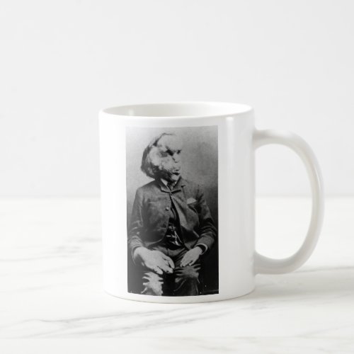 Joseph John Merrick The Elephant Man from 1889 Coffee Mug