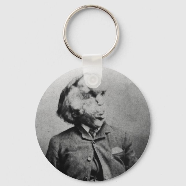 Joseph "John" Merrick The Elephant Man from 1889 Keychain (Front)