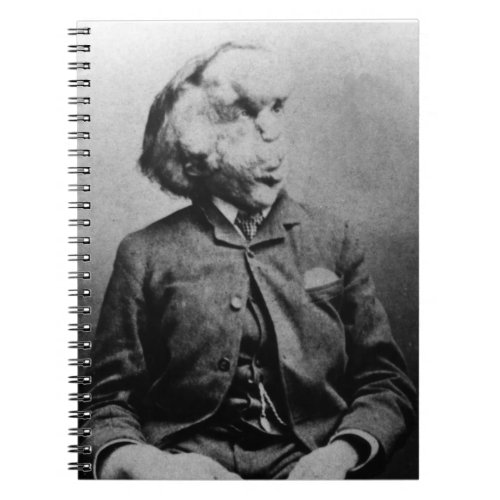 Joseph John Merrick The Elephant Man from 1889 Notebook