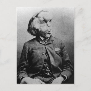 Joseph "John" Merrick The Elephant Man from 1889 Postcard