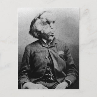 Joseph "John" Merrick The Elephant Man from 1889 Postcard