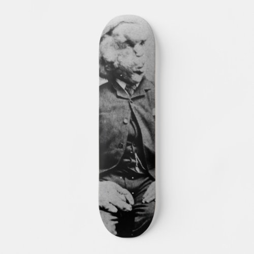 Joseph John Merrick The Elephant Man from 1889 Skateboard