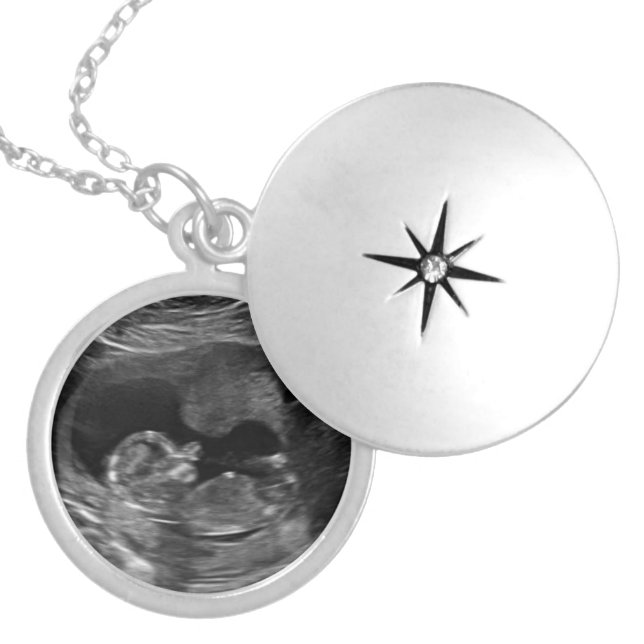 Keepsake Sonogram Locket Necklace (Front)