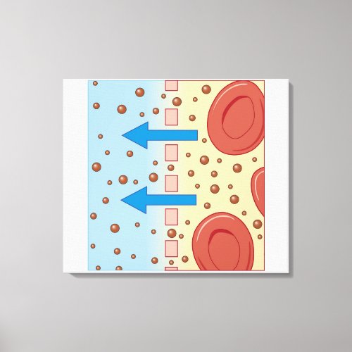 Kidney Dialysis Canvas Print