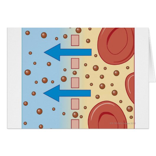 Kidney Dialysis Cards (Front Horizontal)