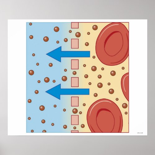 Kidney Dialysis Poster