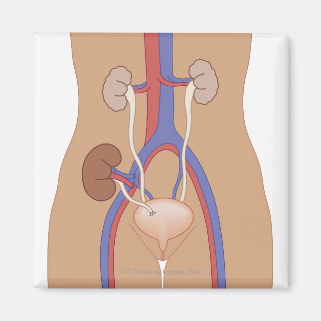 Kidney Transplant Magnet (Front)