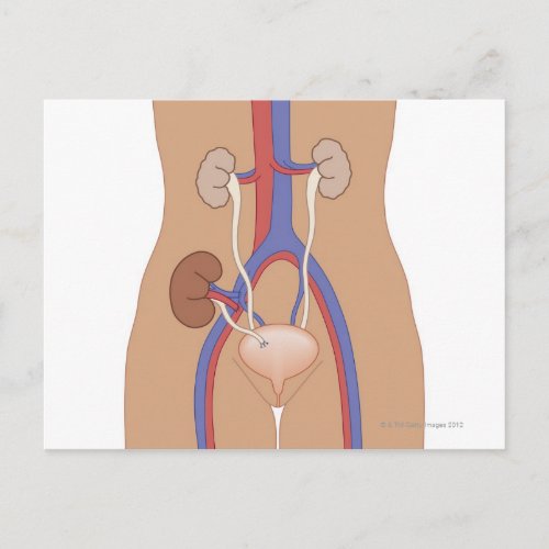 Kidney Transplant Postcard