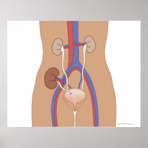 Kidney Transplant Poster