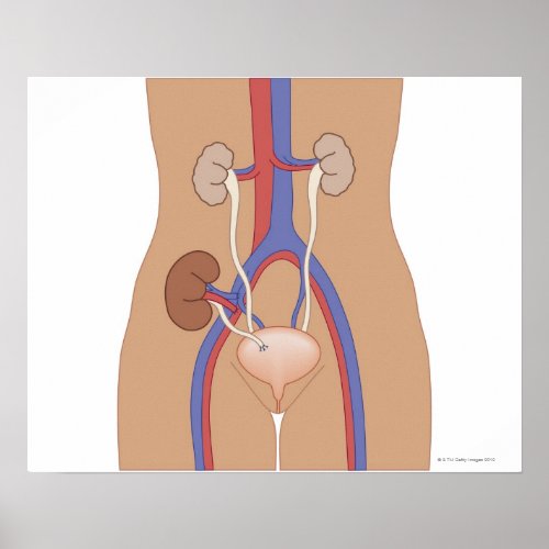 Kidney Transplant Poster